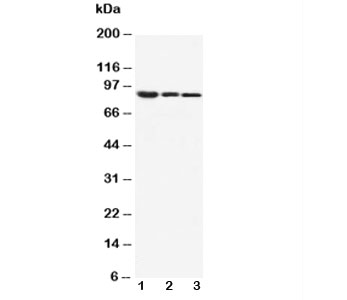 CTNNB1 / Beta Catenin Antibody - Western blot testing of beta Catenin antibody and Lane 1: MM453; 2: MCF-7; 3: HeLa cell lysate