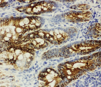 CTNNB1 / Beta Catenin Antibody - IHC-F: beta Catenin antibody testing of rat intestine tissue