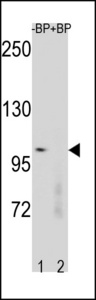 CTNNB1 / Beta Catenin Antibody - Western blot of CTNNB1 Antibody antibody pre-incubated without(lane 1) and with(lane 2) blocking peptide in human placenta tissue lysate. CTNNB1 Antibody (arrow) was detected using the purified antibody.