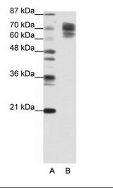 CTNNB1 / Beta Catenin Antibody - A: Marker, B: Jurkat Cell Lysate.  This image was taken for the unconjugated form of this product. Other forms have not been tested.
