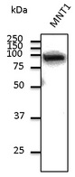CTNNB1 / Beta Catenin Antibody - Western blot. Anti-beta-Catenin antibody at 1:1000 dilution. Lysate at 100 ug per lane. Rabbit polyclonal to goat IgG (HRP) at 1:10000 dilution.