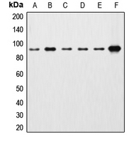 CTNNB1 / Beta Catenin Antibody - Western blot analysis of Beta-catenin expression in HEK293T (A); HeLa (B); A431 (C); MCF7 (D); Raw264.7 (E); rat kidney (F) whole cell lysates.