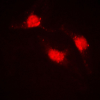 CTNNB1 / Beta Catenin Antibody - Immunofluorescent analysis of Beta-catenin staining in HeLa cells. Formalin-fixed cells were permeabilized with 0.1% Triton X-100 in TBS for 5-10 minutes and blocked with 3% BSA-PBS for 30 minutes at room temperature. Cells were probed with the primary antibody in 3% BSA-PBS and incubated overnight at 4 C in a humidified chamber. Cells were washed with PBST and incubated with a DyLight 594-conjugated secondary antibody (red) in PBS at room temperature in the dark. DAPI was used to stain the cell nuclei (blue).