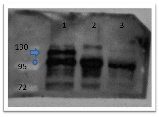 CTNNB1 / Beta Catenin Antibody - Western Blot of rabbit anti-catenin ß-1 antibody Lane 1: zebrafish embryos injected with myc tagged catenin ß 1 mRNA Lane 2: zebrafish embryos injected with myc tagged catenin ß 2 mRNA Lane 3: zebrafish embryos un-injected Primary antibody: catenin ß-1 antibody at 1:500 overnight at 4°C Secondary antibody: goat anti-rabbit HRP at 1:10,000 for 1 hour at RT Predicted/Observed size: 85.5kDa/ ~125kDa (arrow) endogenous catenin ß-1 Other band(s): ~110kDa (star) co-migrating catenin ß-1 and ß-2.