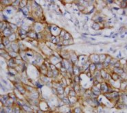 CTNNB1 / Beta Catenin Antibody -  This image was taken for the unconjugated form of this product. Other forms have not been tested.