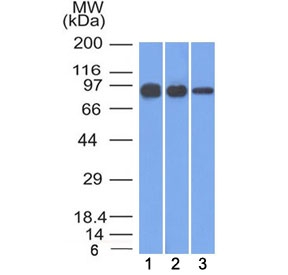 CTNNB1 / Beta Catenin Antibody - Western blot testing of human 1) A431, 2) A549 and 3) MCF7 cell lysate with Beta Catenin antibody (clone 12F7). Expected molecular weight ~92 kDa.