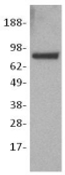 CTNNB1 / Beta Catenin Antibody - Cell lysates prepared from the Jurkat cell line under reducing conditions were immunoblotted with 5 ug/mL anti-human/mouse beta-catenin antibody. Bands were visualized using HRP-conjugated rat anti-mouse IgG antibody.