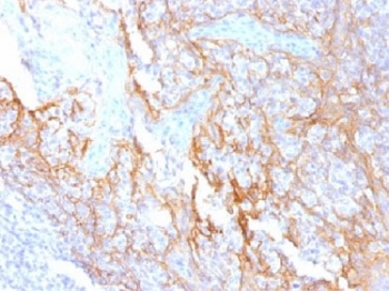CTNNB1 / Beta Catenin Antibody - IHC testing of FFPE human tonsil tissue with Beta Catenin antibody (clone 15B8). Required HIER: boil tissue sections in 10mM Tris with 1mM EDTA, pH 9.0, for 10-20 min.