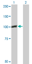 CTNNB1 / Beta Catenin Antibody - Western Blot analysis of CTNNB1 expression in transfected 293T cell line by CTNNB1 monoclonal antibody (M02), clone 1C9.Lane 1: CTNNB1 transfected lysate(85.5 KDa).Lane 2: Non-transfected lysate.