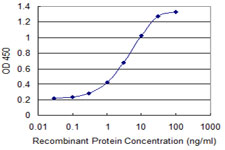 CTNNB1 / Beta Catenin Antibody - Detection limit for recombinant GST tagged CTNNB1 is 0.1 ng/ml as a capture antibody.