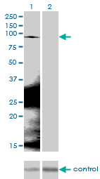 CTNNB1 / Beta Catenin Antibody - Western blot analysis of CTNNB1 over-expressed 293 cell line, cotransfected with CTNNB1 Validated Chimera RNAi (Lane 2) or non-transfected control (Lane 1). Blot probed with CTNNB1 monoclonal antibody (M02), clone 1C9 . GAPDH ( 36.1 kDa ) used as specificity and loading control.