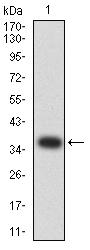 CTNNB1 / Beta Catenin Antibody - Western blot analysis using CTNNB1 mAb against human CTNNB1 (AA: 1-100) recombinant protein. (Expected MW is 37.1 kDa)