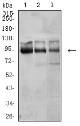CTNNB1 / Beta Catenin Antibody - Western blot analysis using CTNNB1 mouse mAb against A431 (1), U251 (2), and HEK293 (3) cell lysate.