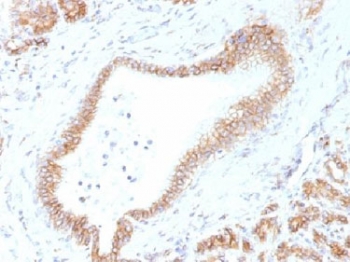 CTNNB1 / Beta Catenin Antibody - IHC testing of FFPE human pancreas tissue with Beta Catenin antibody (clone CTNNB1/1507). Required HIER: boil tissue sections in 10mM Tris with 1mM EDTA, pH 9.0, for 10-20 min.