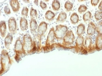 CTNNB1 / Beta Catenin Antibody - IHC testing of FFPE mouse colon tissue with Beta Catenin antibody (clone CTNNB1/1507). Required HIER: boil tissue sections in 10mM Tris with 1mM EDTA, pH 9.0, for 10-20 min.