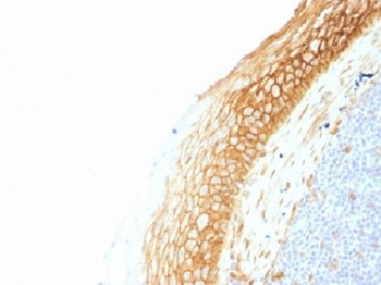 CTNNB1 / Beta Catenin Antibody - IHC testing of FFPE human tonsil tissue with Beta Catenin antibody (clone CTNNB1/1507). Required HIER: boil tissue sections in 10mM Tris with 1mM EDTA, pH 9.0, for 10-20 min.