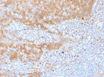 CTNNB1 / Beta Catenin Antibody - IHC testing of FFPE human tonsil tissue with Beta Catenin antibody (clone CTNNB1/1508). Required HIER: boil tissue sections in 10mM Tris with 1mM EDTA, pH 9.0, for 10-20 min.