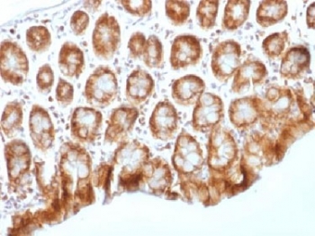 CTNNB1 / Beta Catenin Antibody - IHC testing of FFPE mouse colon tissue with b-Catenin antibody (clone CTNNB1/1509). Required HIER: boil tissue sections in 10mM Tris with 1mM EDTA, pH 9.0, for 10-20 min.