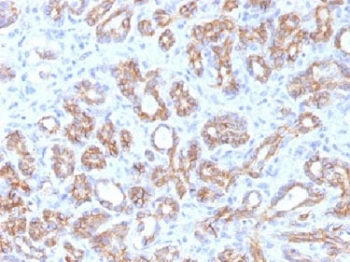 CTNNB1 / Beta Catenin Antibody - IHC testing of FFPE human pancreas tissue with b-Catenin antibody (clone CTNNB1/1509). Required HIER: boil tissue sections in 10mM Tris with 1mM EDTA, pH 9.0, for 10-20 min.