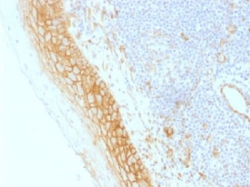 CTNNB1 / Beta Catenin Antibody - IHC testing of FFPE human tonsil tissue with b-Catenin antibody (clone CTNNB1/1509). Required HIER: boil tissue sections in 10mM Tris with 1mM EDTA, pH 9.0, for 10-20 min.