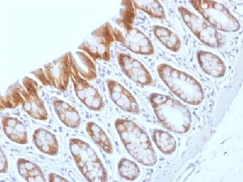 CTNNB1 / Beta Catenin Antibody - IHC testing of FFPE rat colon tissue with b-Catenin antibody (clone CTNNB1/1509). Required HIER: boil tissue sections in 10mM Tris with 1mM EDTA, pH 9.0, for 10-20 min.