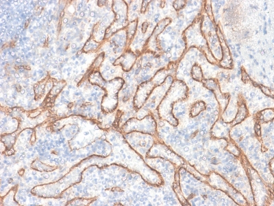 CTNNB1 / Beta Catenin Antibody - Formalin-fixed, paraffin-embedded human Tonsil stained with Beta-Catenin Recombinant Rabbit Monoclonal Antibody (CTNNB1/2030R).