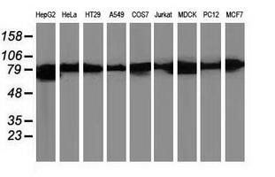 CTNNB1 / Beta Catenin Antibody - Western blot of extracts (35 ug) from 9 different cell lines by using anti-CTNNB1 monoclonal antibody (HepG2: human; HeLa: human; SVT2: mouse; A549: human; COS7: monkey; Jurkat: human; MDCK: canine; PC12: rat; MCF7: human).