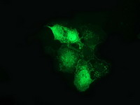 CTNNB1 / Beta Catenin Antibody - Anti-CTNNB1 mouse monoclonal antibody immunofluorescent staining of COS7 cells transiently transfected by pCMV6-ENTRY CTNNB1.