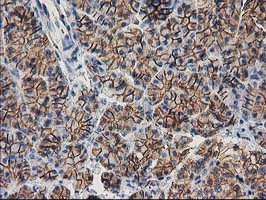 CTNNB1 / Beta Catenin Antibody - IHC of paraffin-embedded Human pancreas tissue using anti-CTNNB1 mouse monoclonal antibody.