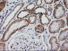 CTNNB1 / Beta Catenin Antibody - IHC of paraffin-embedded Human Kidney tissue using anti-CTNNB1 mouse monoclonal antibody. (Heat-induced epitope retrieval by 10mM citric buffer, pH6.0, 100C for 10min).