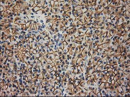CTNNB1 / Beta Catenin Antibody - IHC of paraffin-embedded Human pancreas tissue using anti-CTNNB1 mouse monoclonal antibody. (Heat-induced epitope retrieval by 10mM citric buffer, pH6.0, 100C for 10min).