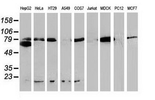 CTNNB1 / Beta Catenin Antibody - Western blot of extracts (35 ug) from 9 different cell lines by using anti-CTNNB1 monoclonal antibody (HepG2: human; HeLa: human; SVT2: mouse; A549: human; COS7: monkey; Jurkat: human; MDCK: canine; PC12: rat; MCF7: human). Recomended dilution of 1:1000 - 1:2000.