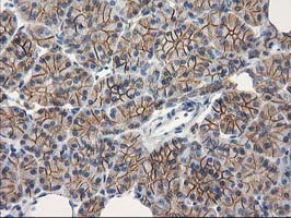 CTNNB1 / Beta Catenin Antibody - IHC of paraffin-embedded Human pancreas tissue using anti-CTNNB1 mouse monoclonal antibody. At a dilution of 1:150.