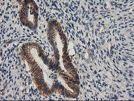 CTNNB1 / Beta Catenin Antibody - IHC of paraffin-embedded Human endometrium tissue using anti-CTNNB1 mouse monoclonal antibody.