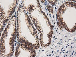 CTNNB1 / Beta Catenin Antibody - IHC of paraffin-embedded Human prostate tissue using anti-CTNNB1 mouse monoclonal antibody.