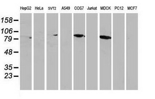CTNNB1 / Beta Catenin Antibody - Western blot of extracts (35ug) from 9 different cell lines by using anti-CTNNB1 monoclonal antibody.