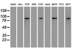 CTNNB1 / Beta Catenin Antibody - Western blot of 35 ug of cell extracts from human colon adenocarcinoma (HT29) cells using anti-CTNNB1 antibody.