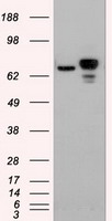 CTNNB1 / Beta Catenin Antibody - HEK293T cells were transfected with the pCMV6-ENTRY control (Left lane) or pCMV6-ENTRY CTNNB1 (Right lane) cDNA for 48 hrs and lysed. Equivalent amounts of cell lysates (5 ug per lane) were separated by SDS-PAGE and immunoblotted with anti-CTNNB1.