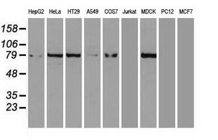 CTNNB1 / Beta Catenin Antibody - Beta-catenin antibody (2H3) at 1:1000 dilution + 293T cell lysate.