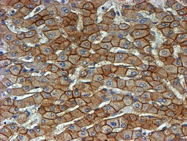 CTNNB1 / Beta Catenin Antibody - IHC of paraffin-embedded Human liver tissue using anti-CTNNB1 mouse monoclonal antibody. (Heat-induced epitope retrieval by 10mM citric buffer, pH6.0, 100C for 10min).