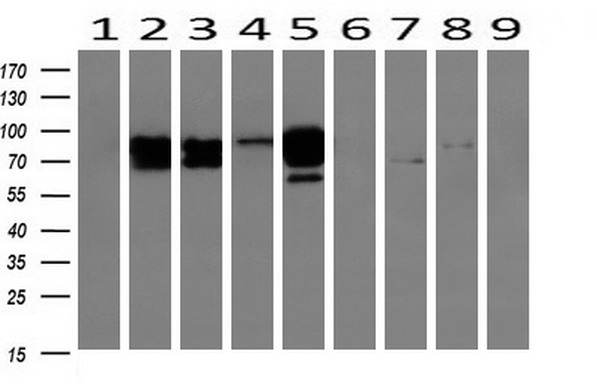CTNNB1 / Beta Catenin Antibody - Western blot of extracts (10ug) from 9 Human tissue by using anti-CTNNB1 monoclonal antibody at 1:200 (1: Testis; 2: Omentum; 3: Uterus; 4: Breast; 5: Brain; 6: Liver; 7: Ovary; 8: Thyroid gland; 9: Colon).