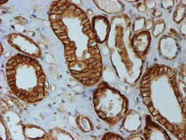 CTNNB1 / Beta Catenin Antibody - IHC of paraffin-embedded Human Kidney tissue using anti-CTNNB1 mouse monoclonal antibody. (Heat-induced epitope retrieval by 10mM citric buffer, pH6.0, 100C for 10min).