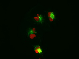 CTNNB1 / Beta Catenin Antibody - Anti-CTNNB1 mouse monoclonal antibody  immunofluorescent staining (Green) of COS7 cells transiently transfected by pCMV6-ENTRY CTNNB1. (The nuclei were counter-stained in red.).