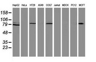 CTNNB1 / Beta Catenin Antibody - Western blot of extracts (35ug) from 9 different cell lines by using anti-CTNNB1 monoclonal antibody (HepG2: human; HeLa: human; SVT2: mouse; A549: human; COS7: monkey; Jurkat: human; MDCK: canine; PC12: rat; MCF7: human).