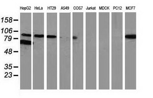 CTNNB1 / Beta Catenin Antibody - Western blot of extracts (35 ug) from 9 different cell lines by using anti-CTNNB1 monoclonal antibody (HepG2: human; HeLa: human; SVT2: mouse; A549: human; COS7: monkey; Jurkat: human; MDCK: canine; PC12: rat; MCF7: human).