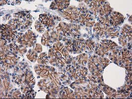 CTNNB1 / Beta Catenin Antibody - IHC of paraffin-embedded Human pancreas tissue using anti-CTNNB1 mouse monoclonal antibody.