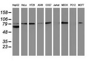 CTNNB1 / Beta Catenin Antibody - Western blot of extracts (35 ug) from 9 different cell lines by using anti-CTNNB1 monoclonal antibody (HepG2: human; HeLa: human; SVT2: mouse; A549: human; COS7: monkey; Jurkat: human; MDCK: canine; PC12: rat; MCF7: human).