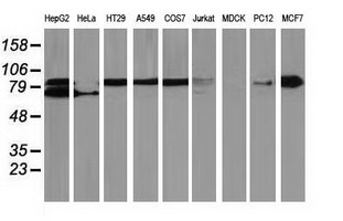 CTNNB1 / Beta Catenin Antibody - Western blot of extracts (35ug) from 9 different cell lines by using anti-CTNNB1 monoclonal antibody (HepG2: human; HeLa: human; SVT2: mouse; A549: human; COS7: monkey; Jurkat: human; MDCK: canine; PC12: rat; MCF7: human).