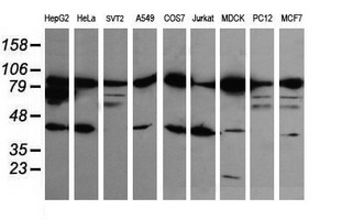 CTNNB1 / Beta Catenin Antibody - Western blot of extracts (35 ug) from 9 different cell lines by using g anti-CTNNB1 monoclonal antibody (HepG2: human; HeLa: human; SVT2: mouse; A549: human; COS7: monkey; Jurkat: human; MDCK: canine; PC12: rat; MCF7: human).