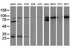 CTNNB1 / Beta Catenin Antibody - Western blot of extracts (35 ug) from 9 different cell lines by using anti-CTNNB1 monoclonal antibody.